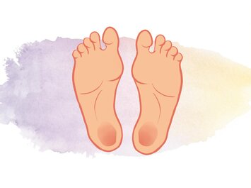 Deux plantes de pieds dessinées avec des zones foncées au niveau des talons, sur un fond clair. | © Gabor Shoes GmbH, Allemagne