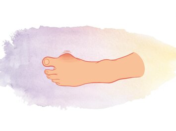 Un dessin d’un pied humain avec un gonflement visible au niveau du gros orteil sur un fond aux couleurs pastel. | © Gabor Shoes GmbH, Allemagne